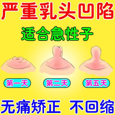 乳头矫正贴男女先天乳头内陷隐形乳头短小增大矫正器