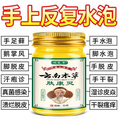 云南本草膏手痒干裂痒手足癣湿疹水泡脱皮真菌感染皮肤瘙痒止痒膏