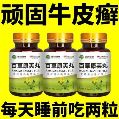 【国药正品】全身顽固性牛皮癣银屑手足头癣癣甘草蒲公英