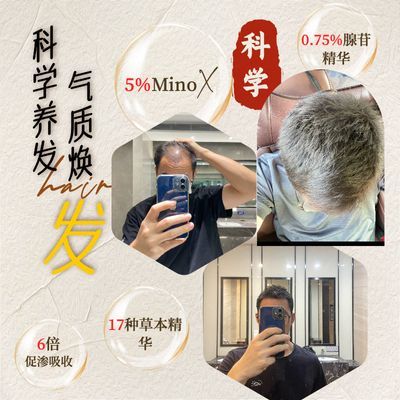 科学育发生发小白瓶 固发养发 防脱发植物草本根源养发60ml