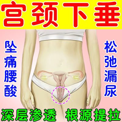 【渗透提拉】宫颈下垂子宫下垂小腹坠胀疼腰酸盆底肌松弛尿频尿急