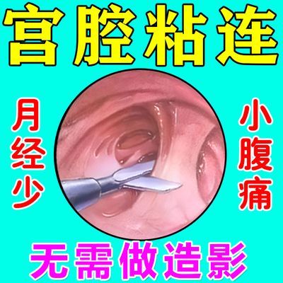 宫腔粘连【保住子宫】子宫内膜修复下腹酸痛月经量少宫腔黏连分离