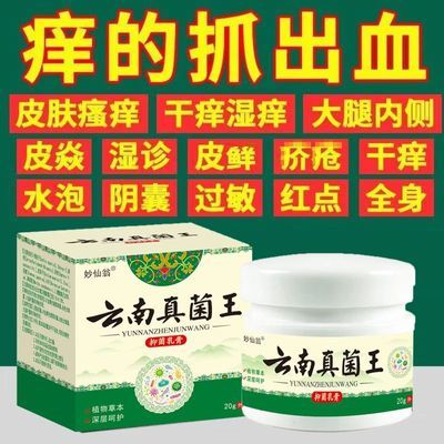 皮肤瘙痒止痒膏快速止痒皮肤干燥瘙痒外用全身干痒云南真菌王正品