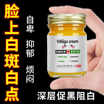 【脸上长白斑】胳膊汗斑花斑深层促黑脖颈腿白癜风皮肤护理外用膏