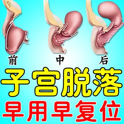 子宫脱落【提宫复位】产后盆底肌松弛阴道壁膨出小腹疼痛月经不调