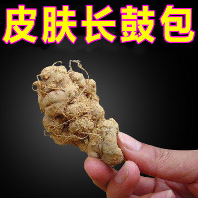 密集脂肪瘤膏皮下单发性多发性脂肪瘤纤维瘤囊肿硬块粉瘤外用乳膏