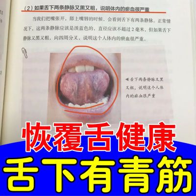 舌下青筋【溶栓化瘀】血管淤堵舌头淤血舌根粗大红肿疼痛抑菌喷剂