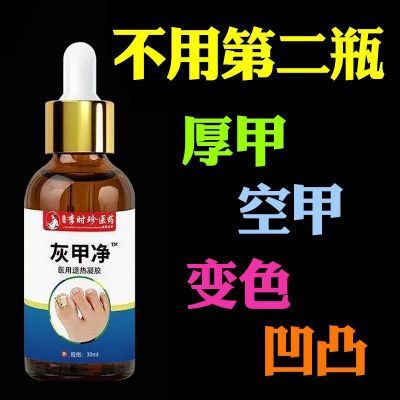 李时珍灰趾甲专用无痛去灰指甲严重甲沟炎指甲增厚抑菌亮甲液