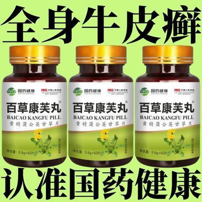 国药健康】牛皮癣银屑手足头癣全身顽固性甘草蒲公英60粒