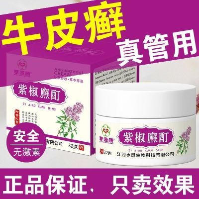 紫椒藓酊顽固牛皮癣银屑病进口特效湿疹皮炎头皮藓