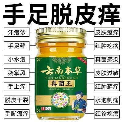 云南本草手足脱皮膏季节性脱皮手上起小水泡手痒脱皮干裂真菌感染