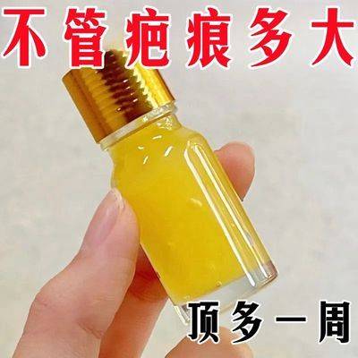 香港正品消除去掉凹凸术后烧伤淡化色素修复净肤无痕仪