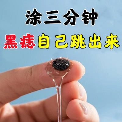 【可碰水 无忌口】哪有黑点抹哪里无痛掉落不留痕点痣膏全身可用