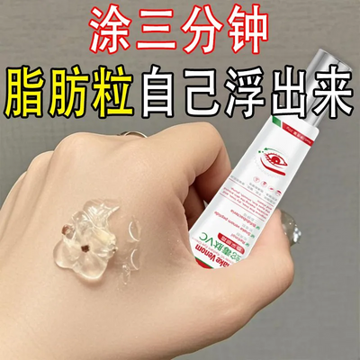 【官方正品】去脂肪粒眼霜汗管粒去除神器重度去油脂粒眼周颗粒