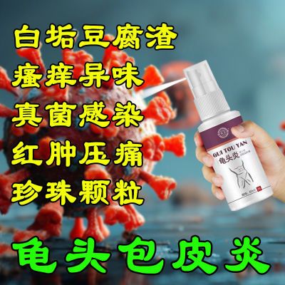 头龟痒发炎感染红疹红点男士私处小颗粒瘙痒包皮豆腐渣白垢止痒液