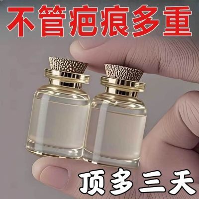 香港推荐/手术/摔伤/烫伤/增生痘坑痘印黑色素祛痘印痘坑单方精油