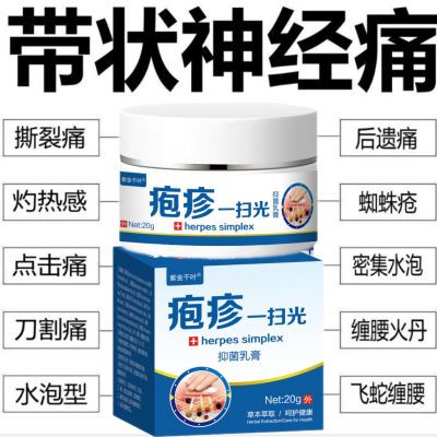 带状疱疹后遗症神经痛蛇盘疮飞蛇缠腰龙外用汗疱疹膏