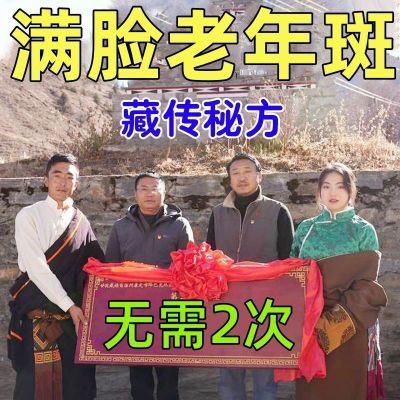 【没效退空瓶】老年斑黄褐斑雀斑斑点晒斑黑色素色斑防晒美白神器