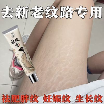 【紧致肌肤强效淡纹】祛生长纹肥胖纹抗皱提亮产后修复霜去妊娠纹