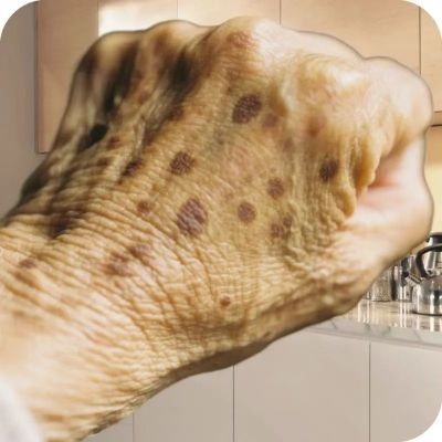 【专祛手上斑】手部祛斑霜美白淡斑面霜去黑色素老年斑晒黄褐斑