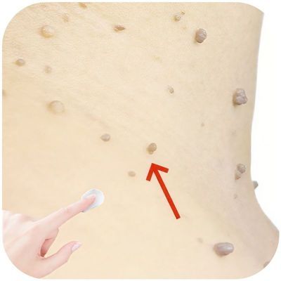 【国货正品】全身通用脖子手足腋下清洁正品本草非医用口罩ATVA