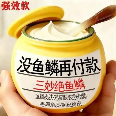 腿上干燥粗糙起皮屑鱼鳞皮蛇皮肤改善鱼鳞皮去鳞屑护肤补水保湿乳