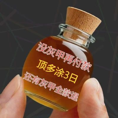 香港重度灰指甲发黄增厚斩草修护除坏甲去灰甲沟炎专用抑菌液