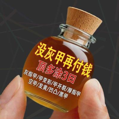 【严重灰指甲】灰指甲灰色指甲趾甲增厚抑菌膏坏甲甲萎缩变色专用