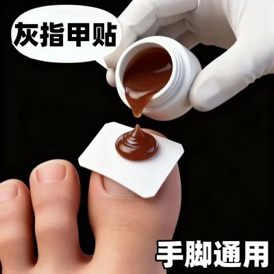 【香港大药房】指甲贴正品专用贴植物萃取脚趾手指甲专用