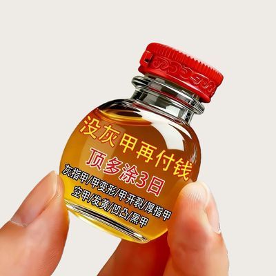 【严重灰指甲】灰指甲灰色指甲趾甲增厚抑菌膏坏甲甲萎缩变色专用