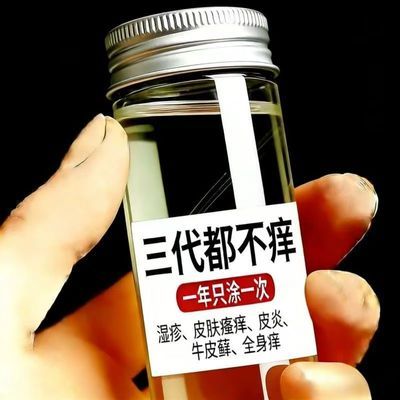 【中俄止痒王】特效皮肤瘙痒外用全身皮肤手脚干痒真菌止痒膏杀菌