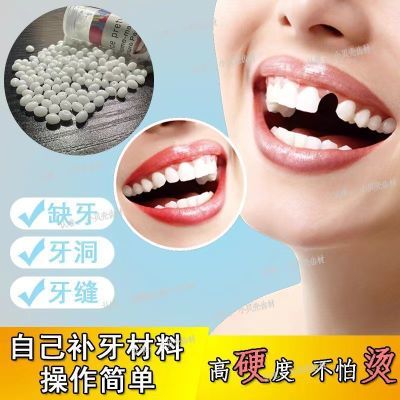 牙齿补缺牙自己动手高硬度进口补牙材料树脂堵填