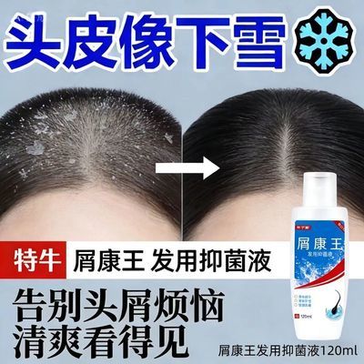 正品屑康净洗发水去头屑止痒洗发大块头皮屑脂溢性毛囊除螨控油