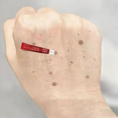 新品】专祛手背斑手部祛斑霜美白淡斑面霜去黑色素老年斑晒黄褐斑