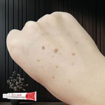 【专祛手上斑】手部祛斑霜美白淡斑面霜去黑色素老年斑晒黄褐斑
