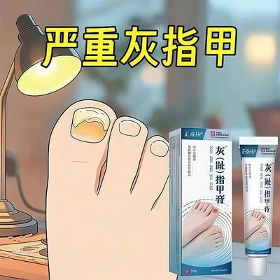 【灰甲指专用】灰指甲灰色指甲趾甲增厚抑菌膏坏甲甲萎缩变色专用