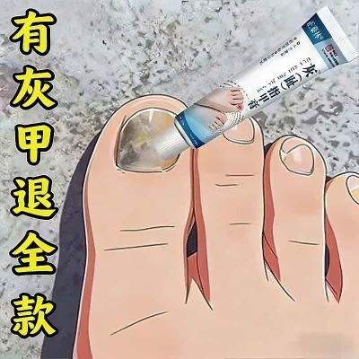 【灰甲指专用】灰指甲灰色指甲趾甲增厚抑菌膏坏甲甲萎缩变色专用