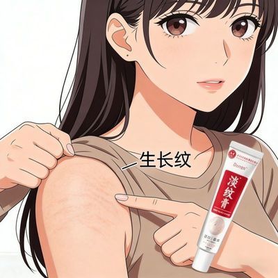 淡纹纹路专用去肥胖纹腿大腹部长纹红纹萎缩纹膨胀纹生长纹白红
