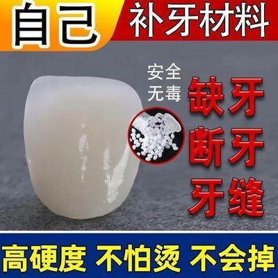 临时假牙动牙齿补缺手高硬度牙洞牙洞颗粒牙缝补牙材料树脂填