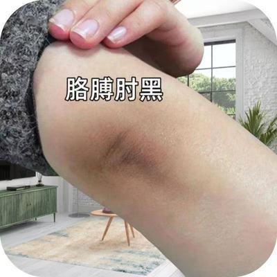 关节去黑神器手胳膊肘膝盖脚踝胳膊脖子腋下淡化黑色素脸部按摩膏