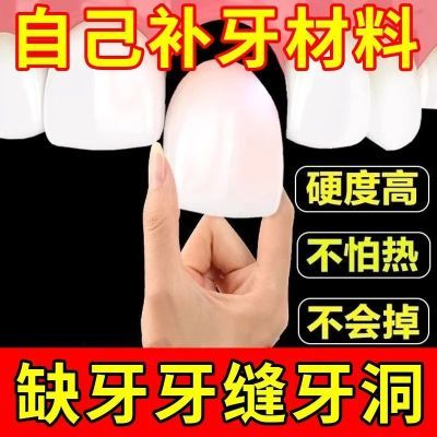【高硬度不怕烫】颗粒补牙神器补牙材料动手牙齿补牙套/正畸用品