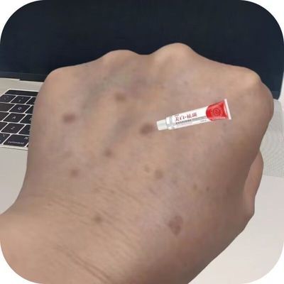 【专祛手背斑】手部祛斑霜美白淡斑面霜去黑色素老年斑晒黄褐斑