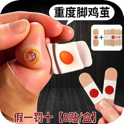 【假一罚十】鸡眼贴手脚趾低手足老茧肉刺跖疣脚脚垫鸡眼贴修脚刀