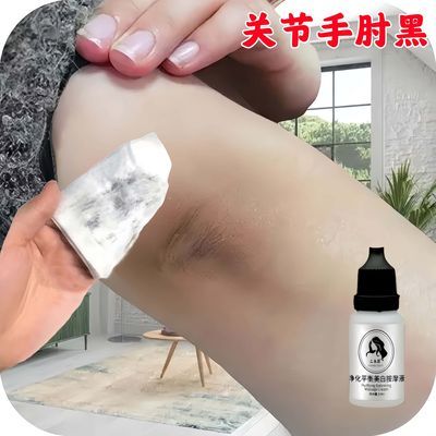 胳膊肘关节黑关节去黑膝盖手胳膊肘脚踝腋下脖子淡化黑色素按摩液