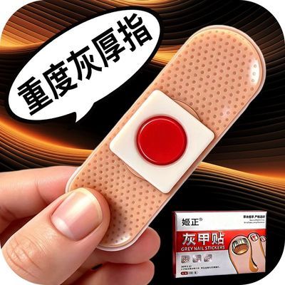 【假一罚十】灰趾甲贴正品抑菌灭菌专用贴植物萃取脚趾手指甲通用