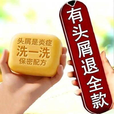 【头皮像下雪】毛囊净皂控油去油去屑止痒疙瘩除螨虫洗发男女通用