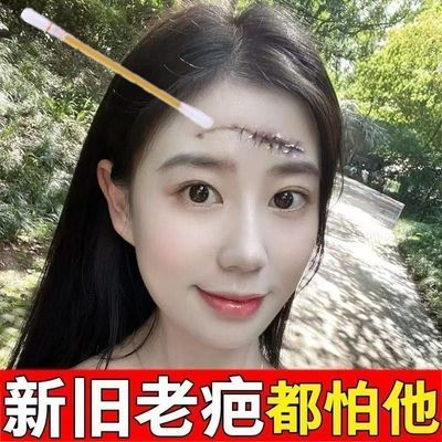强效去疤】旧疤伤疤淡印疤痕修复棉签增生外用去疤痕