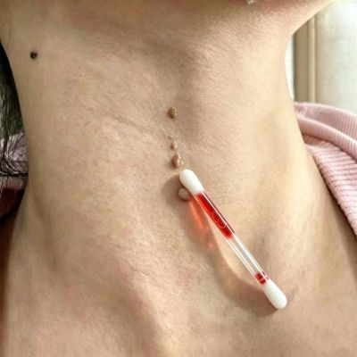 【专祛小肉粒】正品鸦胆子精油全身通用男女植萃抑菌提取棉棒型