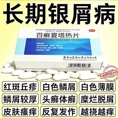 【济仁】 百癣夏塔热片 0.31g*24片/盒 牛皮癣吃的药银屑病皮肤瘙痒起皮体股癣手足癣去癣百癣夏塔热片优惠商品图片