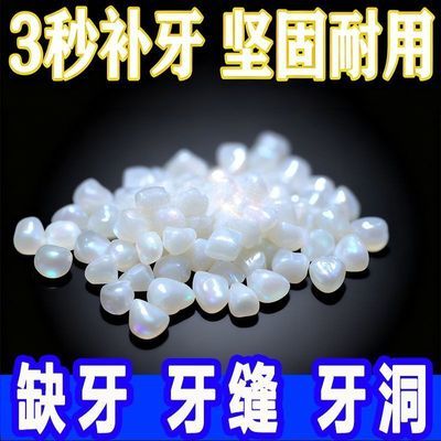 进口补牙神器树脂补牙材料自己动手补缺牙洞临时假牙齿缝大高硬度